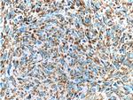 c-Kit/CD117 Antibody in Immunohistochemistry (Paraffin) (IHC (P))