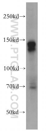 c-Kit/CD117 Antibody in Western Blot (WB)