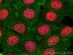 ZBTB7A Antibody in Immunocytochemistry (ICC/IF)