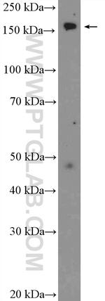 CPS1 Antibody in Western Blot (WB)