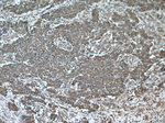 Cytokeratin 18 Antibody in Immunohistochemistry (Paraffin) (IHC (P))