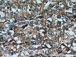 Cytokeratin 18 Antibody in Immunohistochemistry (Paraffin) (IHC (P))