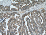 Cytokeratin 18 Antibody in Immunohistochemistry (Paraffin) (IHC (P))