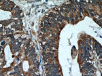 Cytokeratin 18 Antibody in Immunohistochemistry (Paraffin) (IHC (P))