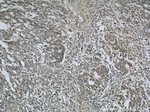 Cytokeratin 18 Antibody in Immunohistochemistry (Paraffin) (IHC (P))