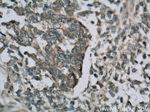 Cytokeratin 18 Antibody in Immunohistochemistry (Paraffin) (IHC (P))