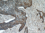 Cytokeratin 18 Antibody in Immunohistochemistry (Paraffin) (IHC (P))