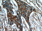 Cytokeratin 18 Antibody in Immunohistochemistry (Paraffin) (IHC (P))