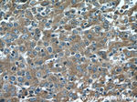 Cytokeratin 18 Antibody in Immunohistochemistry (Paraffin) (IHC (P))