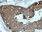 Cytokeratin 18 Antibody in Immunohistochemistry (Paraffin) (IHC (P))