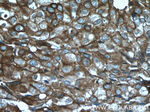 Cytokeratin 18 Antibody in Immunohistochemistry (Paraffin) (IHC (P))
