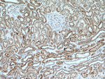 Cytokeratin 18 Antibody in Immunohistochemistry (Paraffin) (IHC (P))