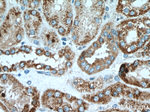 Cytokeratin 18 Antibody in Immunohistochemistry (Paraffin) (IHC (P))