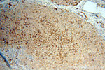 Cytokeratin 18 Antibody in Immunohistochemistry (Paraffin) (IHC (P))