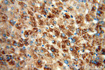 Cytokeratin 18 Antibody in Immunohistochemistry (Paraffin) (IHC (P))