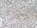Cytokeratin 18 Antibody in Immunohistochemistry (Paraffin) (IHC (P))
