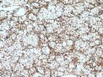 Cytokeratin 18 Antibody in Immunohistochemistry (Paraffin) (IHC (P))