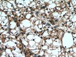 Cytokeratin 18 Antibody in Immunohistochemistry (Paraffin) (IHC (P))