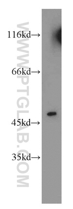 Cytokeratin 18 Antibody in Western Blot (WB)