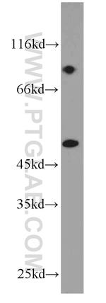 Cytokeratin 18 Antibody in Western Blot (WB)