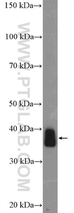MEF2B Antibody in Western Blot (WB)