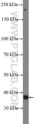 MEF2B Antibody in Western Blot (WB)