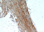 CKM Antibody in Immunohistochemistry (Paraffin) (IHC (P))