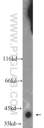 CKM Antibody in Western Blot (WB)