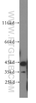 Creatine kinase B type Antibody in Western Blot (WB)