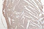 SPEG Antibody in Immunohistochemistry (Paraffin) (IHC (P))