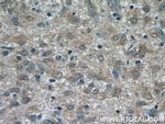 RAB9A Antibody in Immunohistochemistry (Paraffin) (IHC (P))