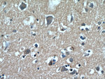 GABARAPL2 Polyclonal Antibody