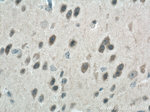 LC3B Antibody in Immunohistochemistry (Paraffin) (IHC (P))
