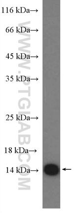 LC3B Antibody in Western Blot (WB)