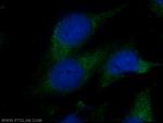 LC3C Antibody in Immunocytochemistry (ICC/IF)