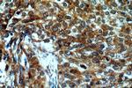 DNA2 Antibody in Immunohistochemistry (Paraffin) (IHC (P))