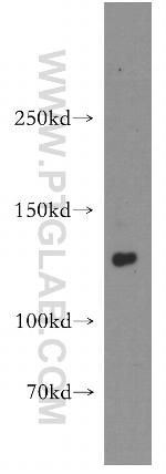 DNA2 Antibody in Western Blot (WB)