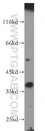 CYLC2 Antibody in Western Blot (WB)