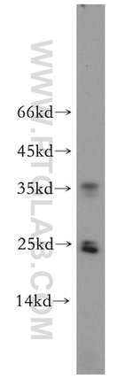GPX5 Antibody in Western Blot (WB)
