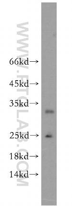 GPX5 Antibody in Western Blot (WB)