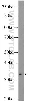 HOXD11 Antibody in Western Blot (WB)