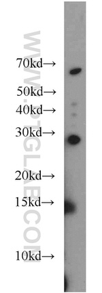 HOXD12 Antibody in Western Blot (WB)