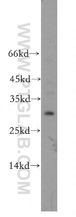 HOXD12 Antibody in Western Blot (WB)