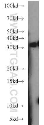 HOXD12 Antibody in Western Blot (WB)