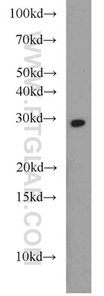 HOXD12 Antibody in Western Blot (WB)