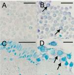 Rhinovirus 16 Antibody in Immunohistochemistry (IHC)