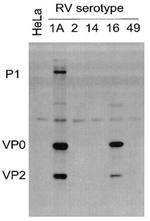 Rhinovirus 16 Antibody in Western Blot (WB)