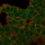 E4F1 Monoclonal Antibody (PCRP-E4F1-2D1)