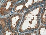 GNMT Antibody in Immunohistochemistry (Paraffin) (IHC (P))