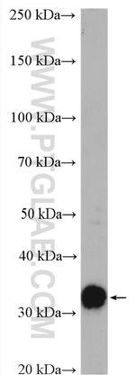 GNMT Antibody in Western Blot (WB)